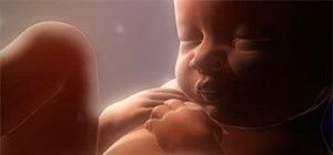 Síndrome de Down Diagnóstico prenatal