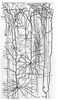 Red de neuronas  Sindrome de Down
